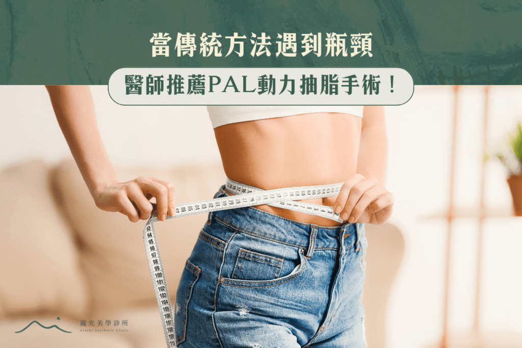 當傳統方法遇到瓶頸:醫師推薦PAL動力抽脂手術!