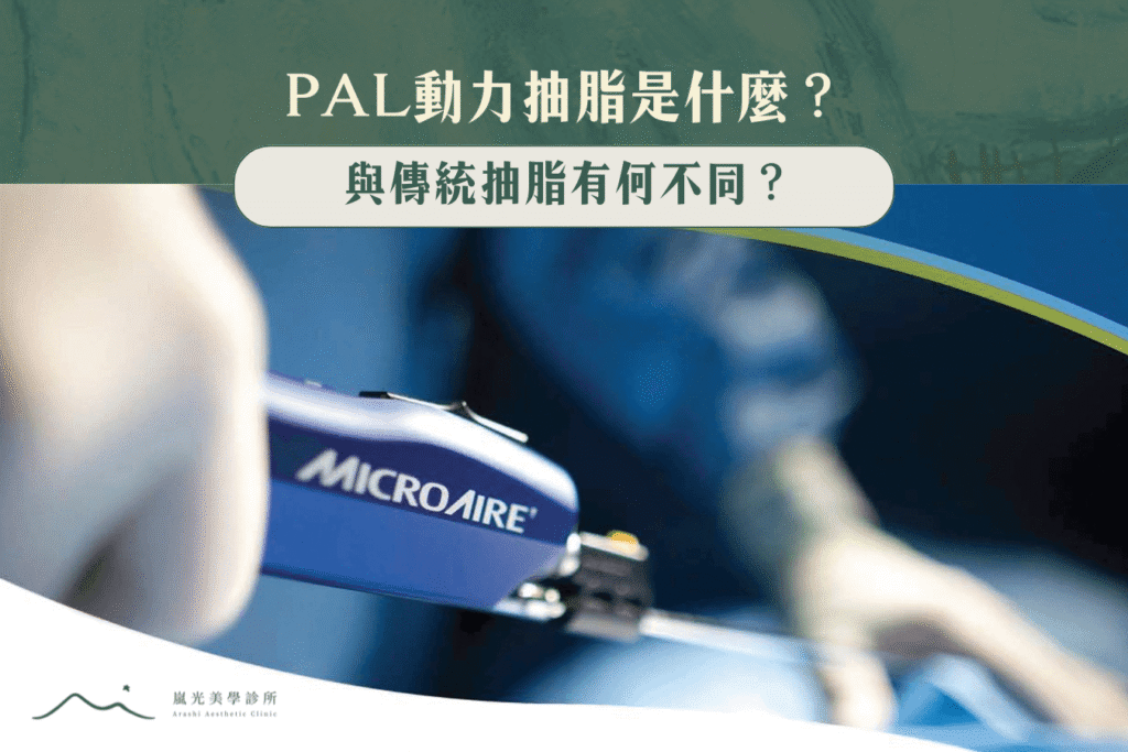 PAL動力抽脂是什麼？與傳統抽脂有何不同？